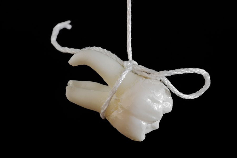 Why Tooth Extraction Might Be Necessary